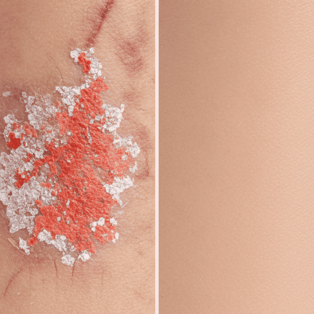 Sérum niacinamide 10 + TXA 4